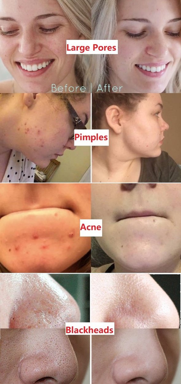 𝐿𝑚𝑖𝑝𝑘𝑖®  Green Tea Deep Cleanse Mask Stick