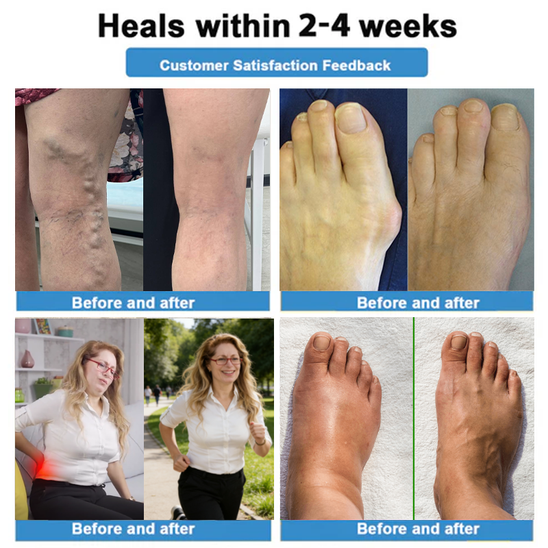 🇦🇺Healrize® 🎉4-in-1 Vein & Joint Nano Microneedle Advanced Therapy Patch🔥(Once daily, visible results in 7 days — supports arthritis, varicose veins, diabetic foot, and nerve pain.)