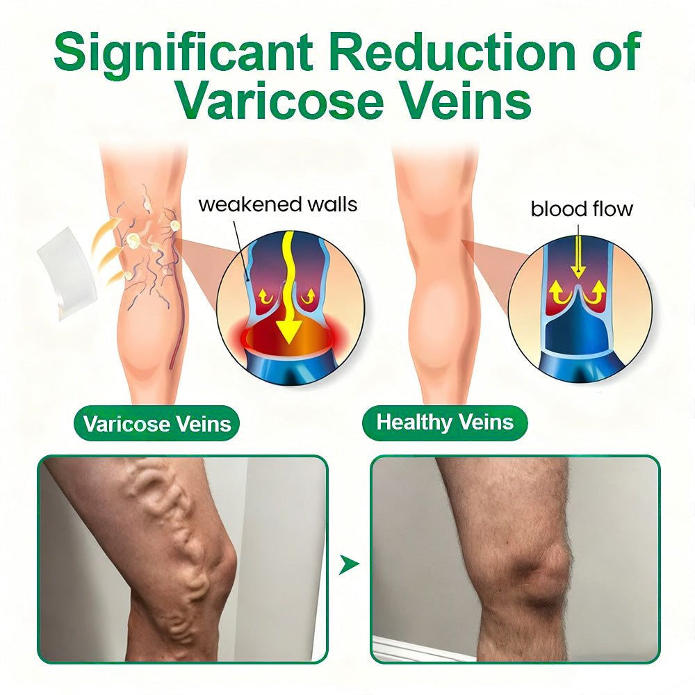 👩‍⚕️Healrize® VeinTarget Microneedle Patch⚡Instant Relief, Long-Term Results👍