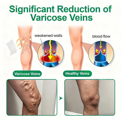 👩‍⚕️Healrize® VeinTarget Microneedle Patch⚡Instant Relief, Long-Term Results👍