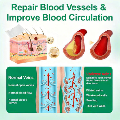 👩‍⚕️Healrize® VeinTarget Microneedle Patch⚡Instant Relief, Long-Term Results👍